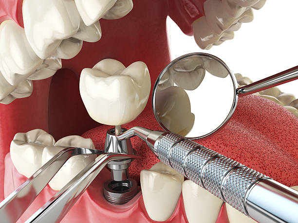 Best Root Canal Emergency Dentist  in Belzoni, MS