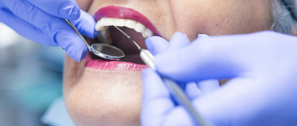 Emergency Dental Filling Replacement in MS